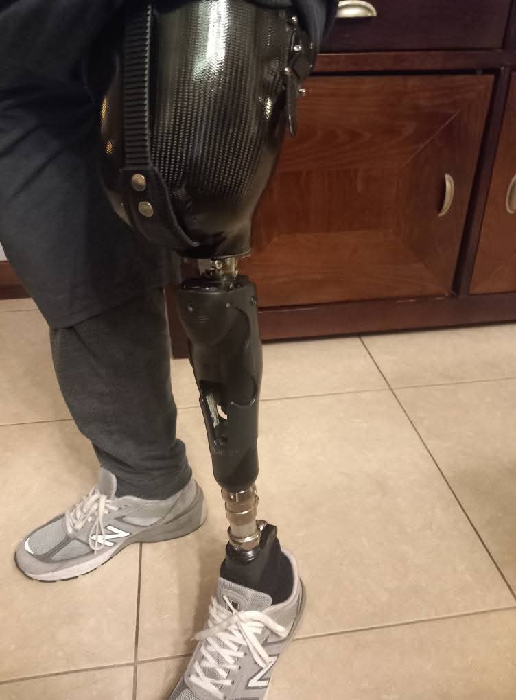 Pod Górę Amputowani Zawsze Razem 